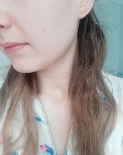 Customer photo review of Photon Therapy Mask