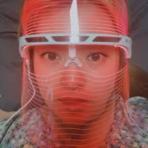 Customer photo review of Photon Therapy Mask