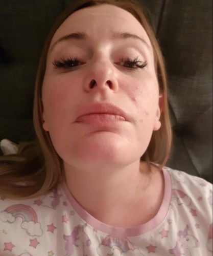 Customer photo review of Photon Therapy Mask