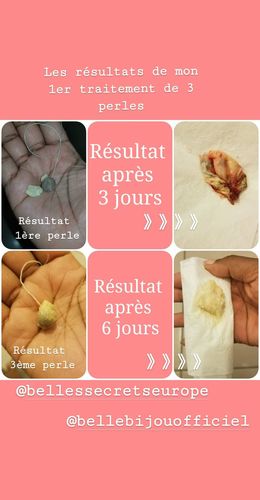 Customer photo review of Perles détoxifiantes
