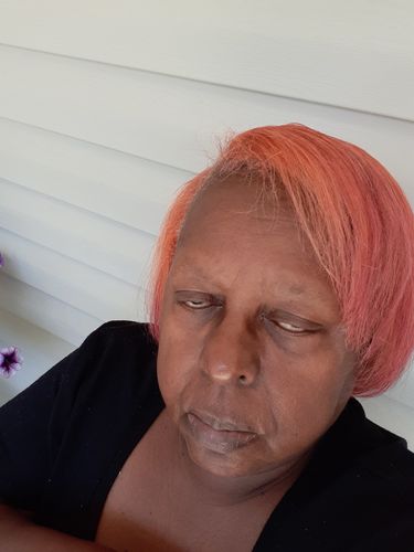 Customer photo review of PureFix Hair Elixir