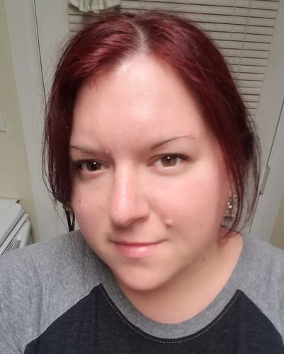 Customer photo review of Mint Purifying Serum