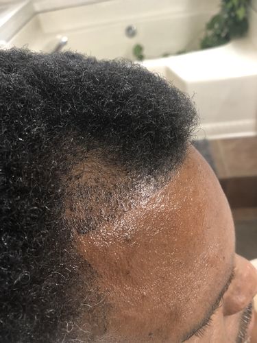 Customer photo review of Nae Nae's 9oz Hair Boost Special