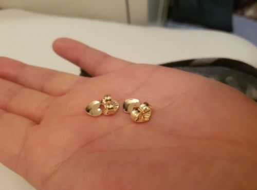Customer photo review of EarLifters™