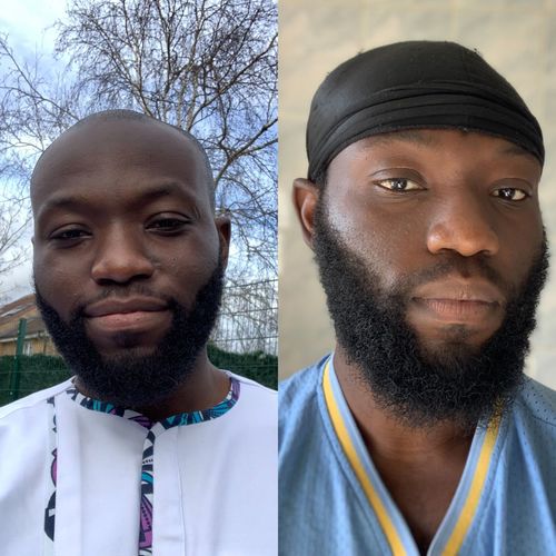 Customer photo review of Inches - Ayurvedic Hair & Beard Growth Oil