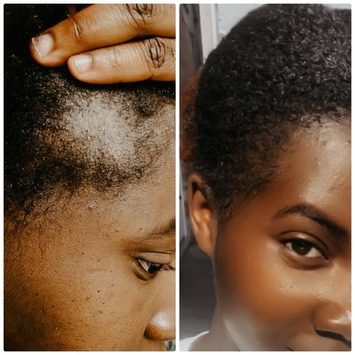 Customer photo review of Inches - Ayurvedic Hair & Beard Growth Oil