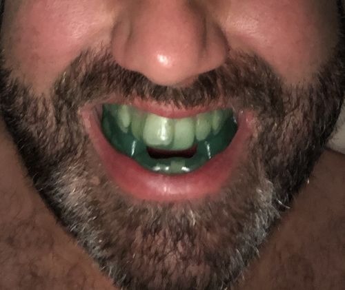 Customer photo review of SleepPro Custom AM