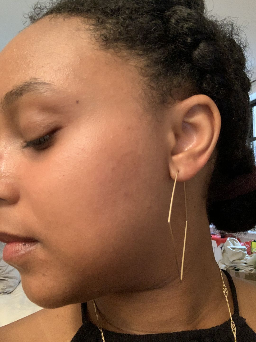 Customer photo review of Bolden Clear Skin Kit