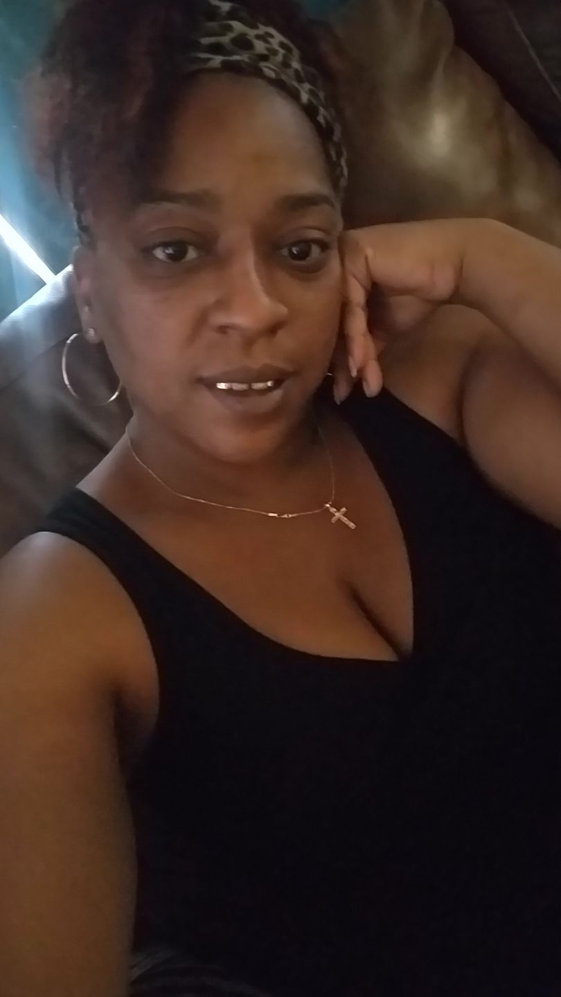 Customer photo review of A-Dream Brightening Eye Cream