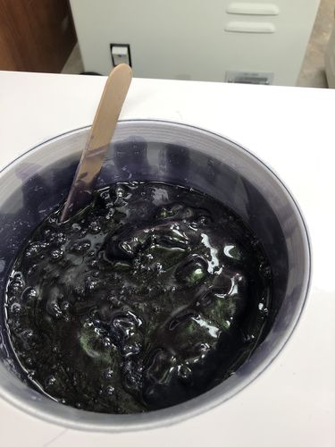 Customer photo review of Pro Series Hair Removal Wax