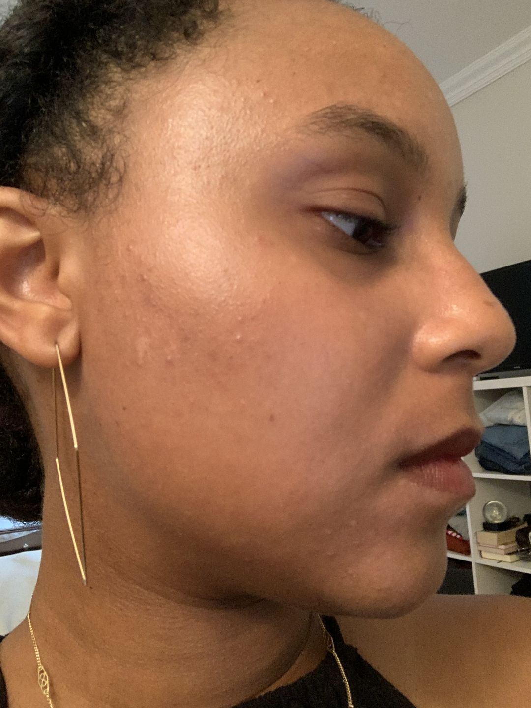 Customer photo review of Clear Skin Clay Mask