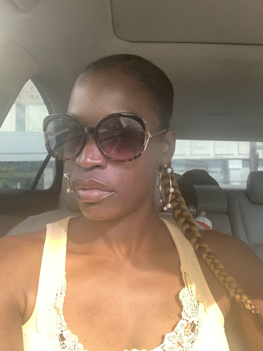 Customer photo review of Bolden Clear Skin Kit