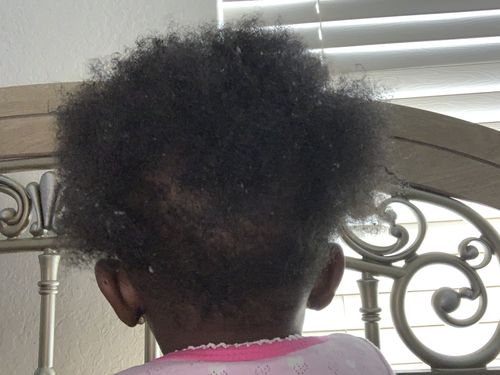 Customer photo review of Hydrating Mist