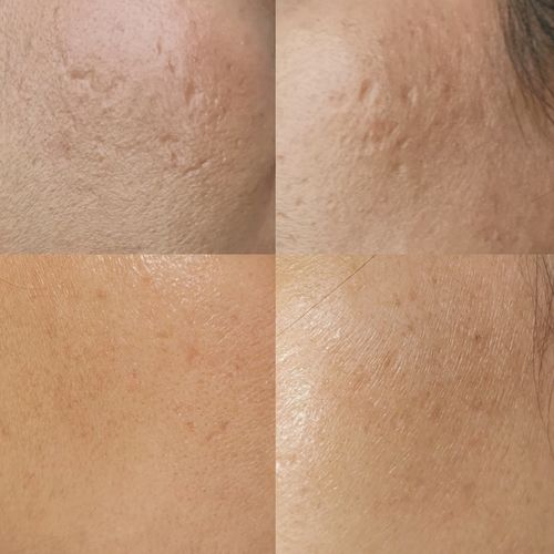 Customer photo review of Niacid