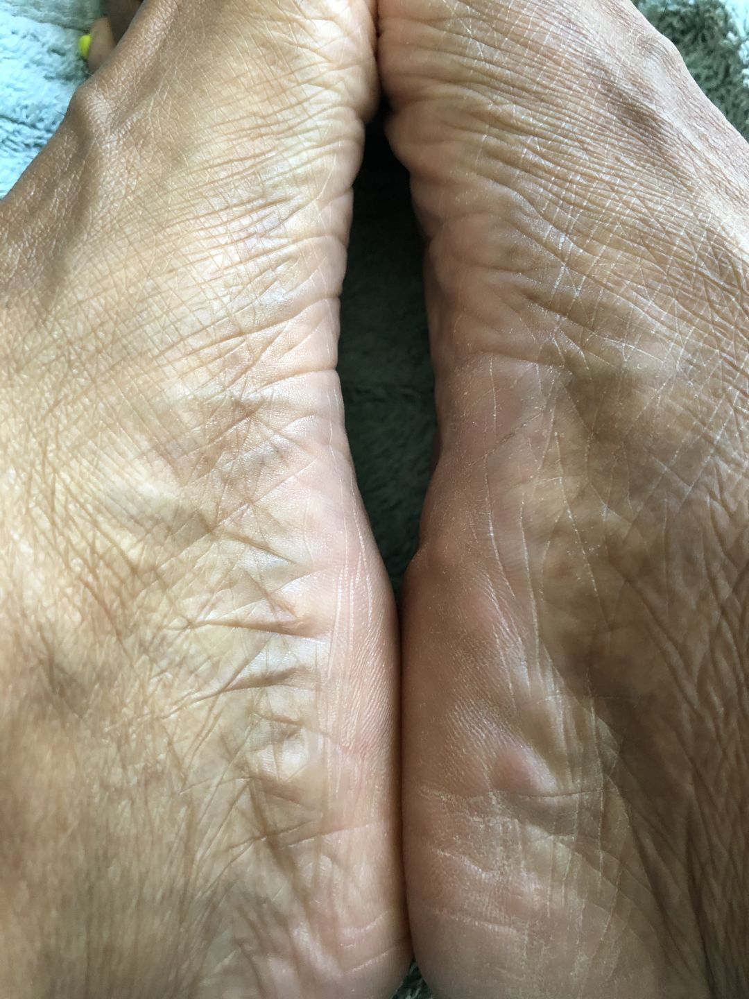 Customer photo review of Body Butta