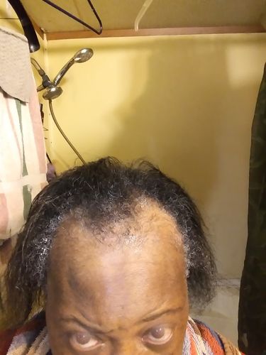 Customer photo review of Nae Nae's 9oz Hair Boost Special