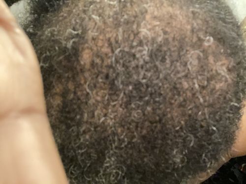 Customer photo review of Nae Nae's 9oz Hair Boost Special