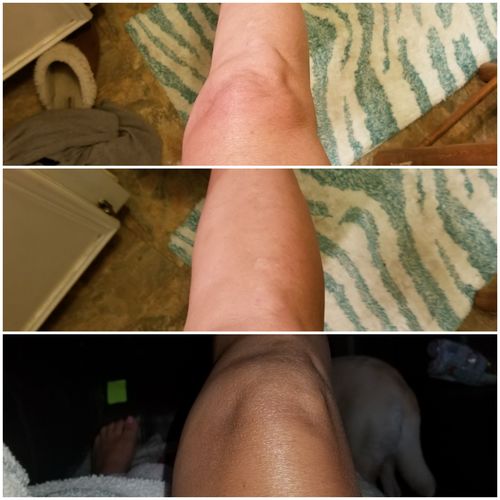 Customer photo review of Desert Bronze Self Tanning Mousse READY TO SHIP!!