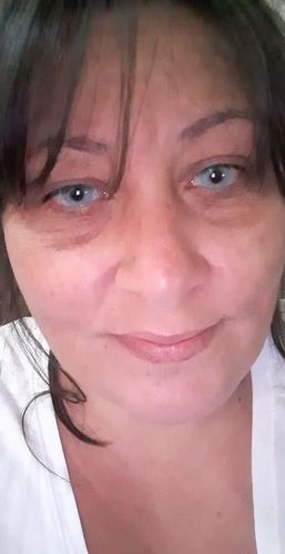 Customer photo review of Hidrocor Topaz Colored Contact Lenses