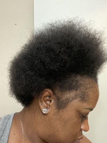 Customer photo review of PureFix Hair Elixir