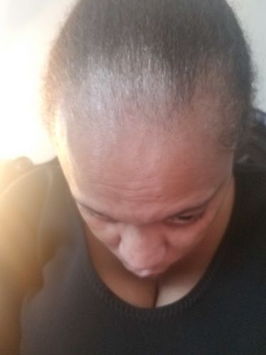 Customer photo review of Nae Nae's 9oz Hair Boost Special