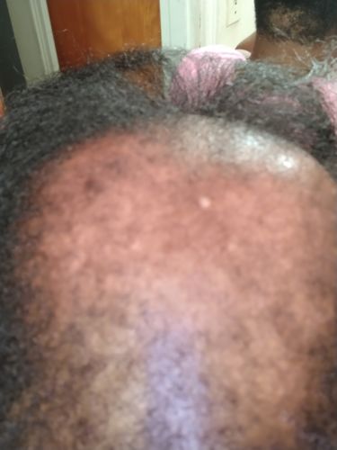 Customer photo review of PureFix Hair Elixir