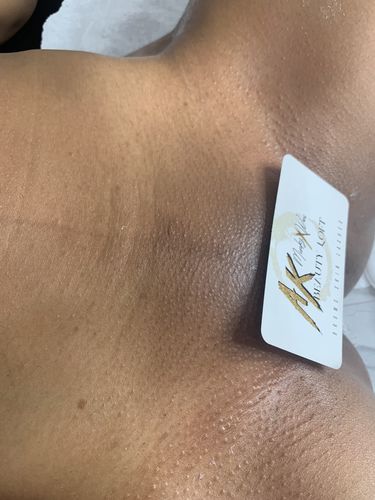 Customer photo review of Pro Series Hair Removal Wax