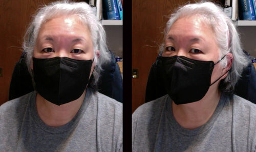 Customer photo review of SOOMLAB MASK