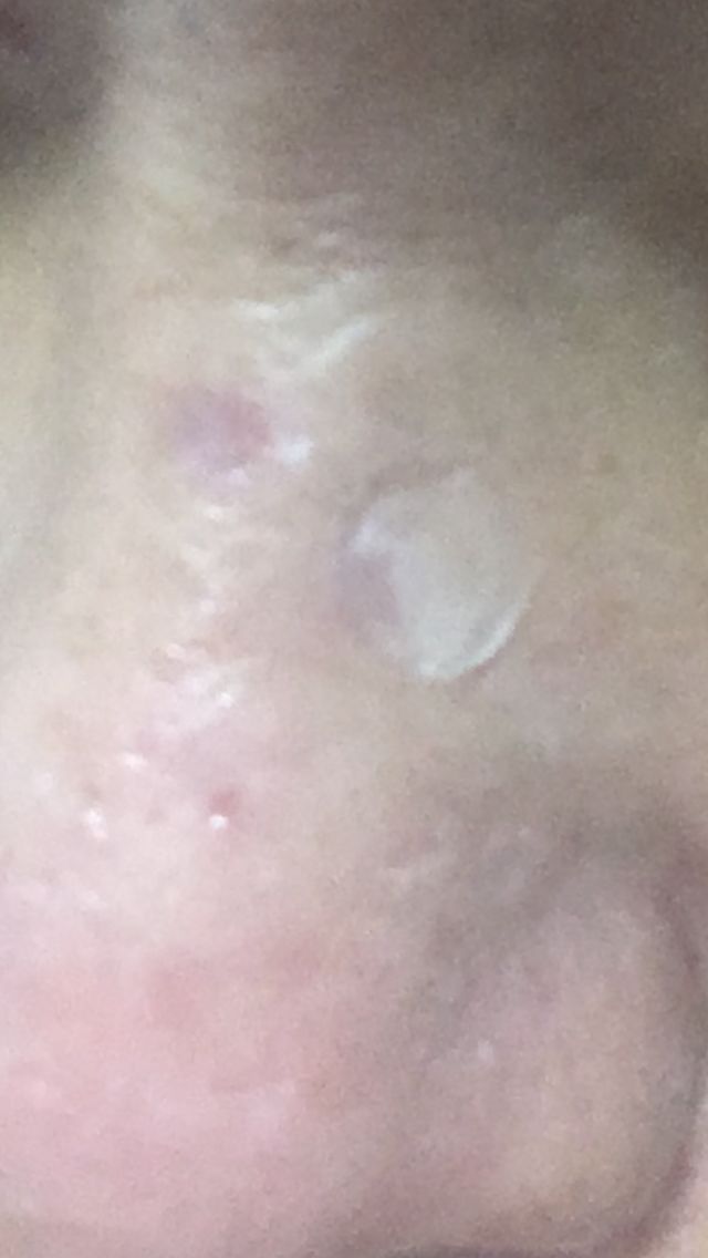 Customer photo review of Dr. wonder Wonder Patch
