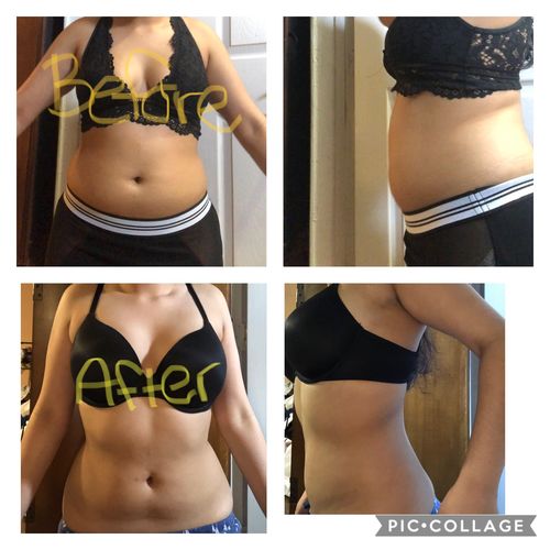 Customer photo review of 15 Uses Magnesium Therapy Herbal Wrap