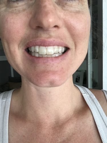 Customer photo review of Night Guard