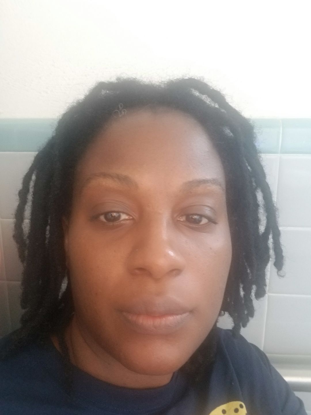 Customer photo review of Bolden Clear Skin Kit