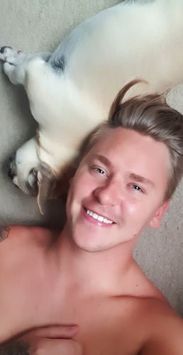 Customer photo review of Teeth Whitening Kit