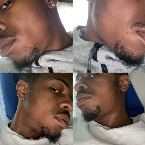 Customer photo review of Inches - Ayurvedic Hair & Beard Growth Oil