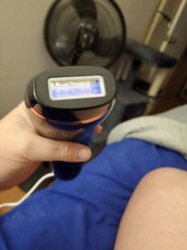 Customer photo review of Waxaro™ Professional Laser Hair Removal For Women