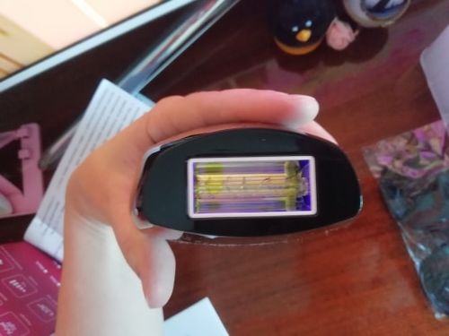 Customer photo review of Best at Home IPL Laser Hair Removal Device