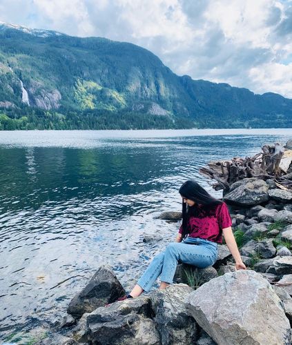 Customer photo review of NovaBunion™ Orthopedic Corrector Sleeve (1 pair)