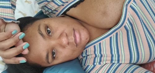 Customer photo review of Fair and White Exclusive Gel Cream 30ml / 1 fl oz