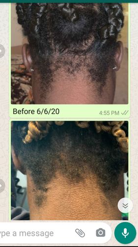 Customer photo review of Nae Nae's Hair Boost 9oz