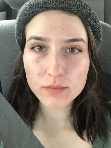 Customer photo review of Micdrop Kristin - green