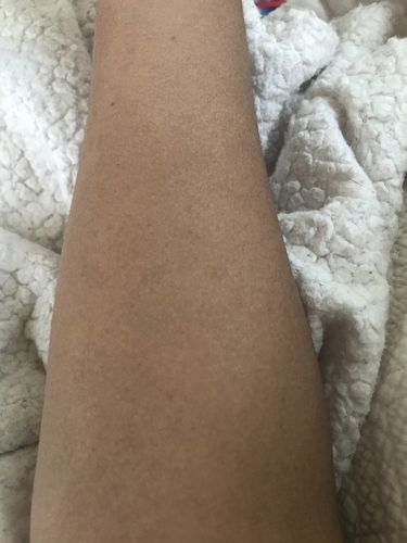 Customer photo review of Fair and White Exclusive Body Lotion with Pure Vitamin "C" 500ml 16.9 fl oz