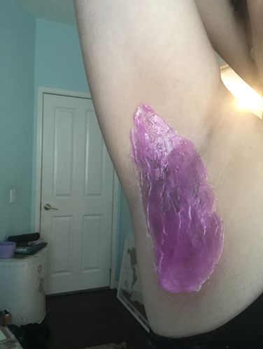 Customer photo review of At-Home Signature Series Hair Removal Wax