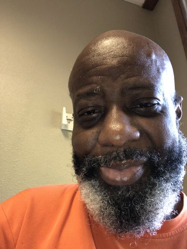 Customer photo review of Kidney RX