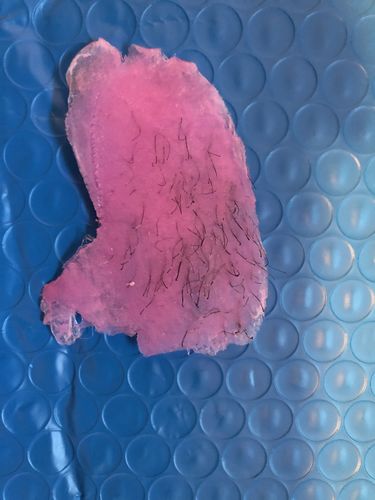 Customer photo review of At-Home Signature Series Hair Removal Wax