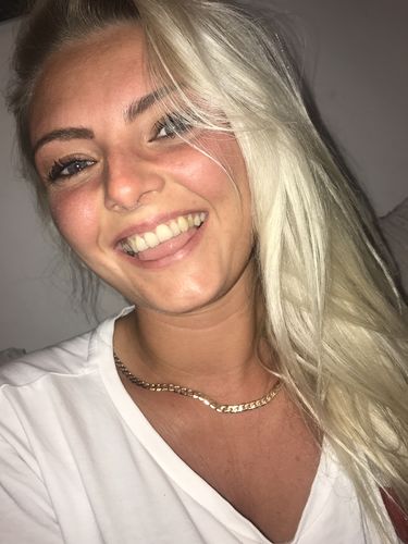 Customer photo review of Invisible Aligners