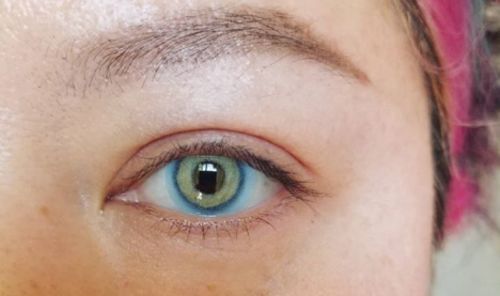 Customer photo review of Icoloured® Gaea Blue Colored Contact Lenses