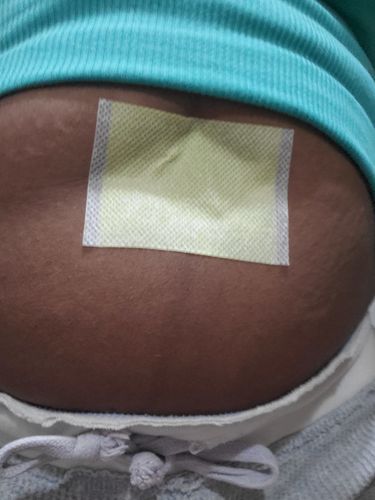Customer photo review of Navel Sticker Slim Weight Loss Burning Patch