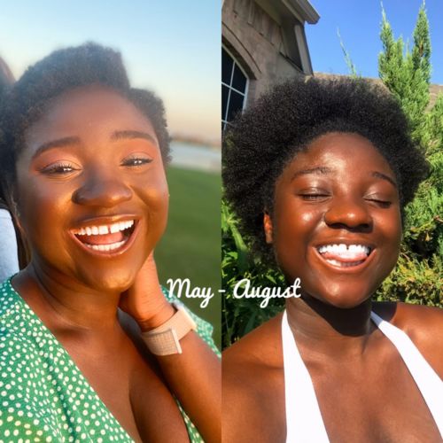 Customer photo review of Inches - Ayurvedic Hair & Beard Growth Oil