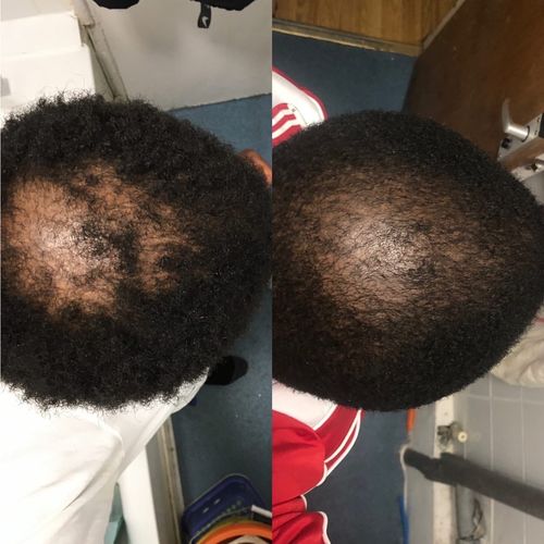 Customer photo review of Inches - Ayurvedic Hair & Beard Growth Oil