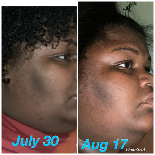 Customer photo review of SkinCare Bundle
